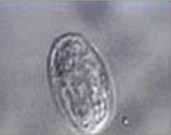 Giardia cyst