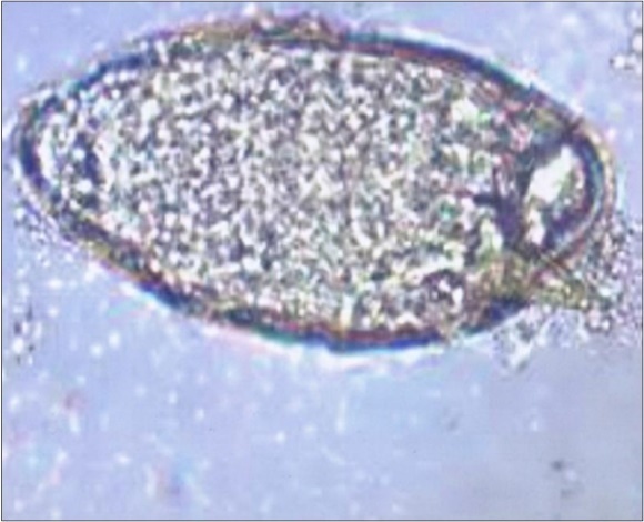 Schistosoma mansoni egg