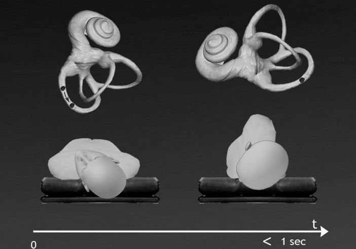 The “Fake-QLR” maneuver for left posterior canal BPPV