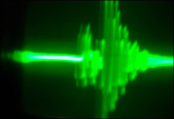 Oscillograph of the collector voltage in the physical model of the system (7) with two identical coils in two shoulders of the multivibrator – one on the ferrite core, the other – in the air.(Fig.13). Corresponds to the solution of (7) in Fig.15.Vert axis μsec/cm , Horiz axis-2volts per cm.