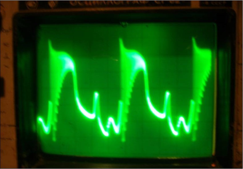 Oscillograph of the both transistors collector voltage in the physical model (Fig.13) of the system (7) corresponding to the interaction process between two FPU recurrences corresponding to the interaction dynamics of the electron current Ielectron. and that of the phonon current Iphonon. Corresponds to the balanced case.. Vert axis milli sec/cm, Horiz axis-3volts per cm.