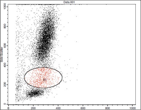 C. Forward Scattering (HCC Patient)