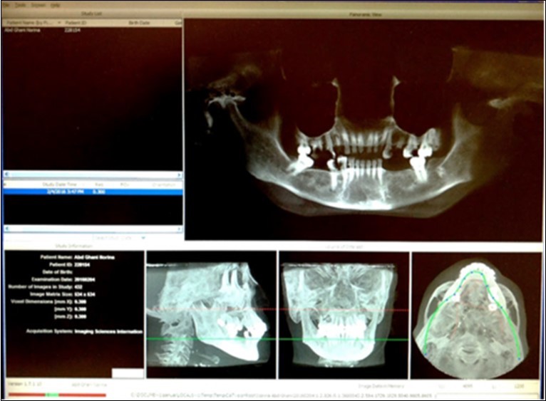 Screenshot of i-CAT Vision Program