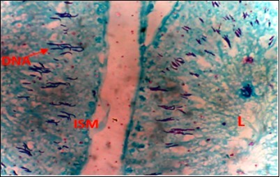 Diabetic Control (DC) X400 – Section of testis showing scanty DNA stained with magenta colour. DNA strands are cross linked and appear in clusters