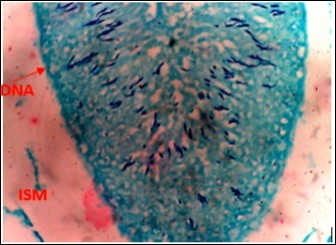 DC+250mg/kg.bw of AP X400 – Section of testis showing scanty DNA deeply stained with magenta color. DNA strands are in clusters