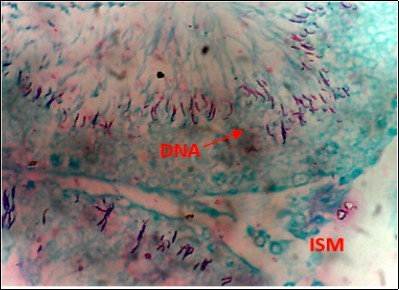 (DC+1000mg/kg.bw of AP) X400 – Section of testis showing scanty DNA deeply stained with magenta color. DNA strands has reduced clusters