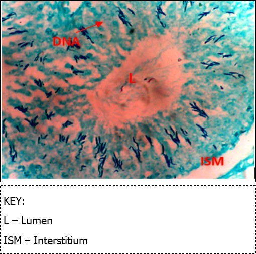 (DC+Metformin) X400 – Section of testis showing deeply stained DNA with magenta color. DNA strands are higher clusters.