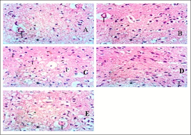 Showing the pituitary of mice. Group A shows the normal pituitary gland (Pars nervosa) consisting of essentially appearing pituitcytes and the capillaries (up arrow). Group B shows the capillary (up arrow). Group C shows a number of pituitcytes and a remarkably appearing micromophorlogy. Group D shows the capillary (up arrow) free from cellular and vascular response. The pituitcytes appear normal. Group E shows congestion in the capillary (up arrow) showing cellular response. (x400) H&E