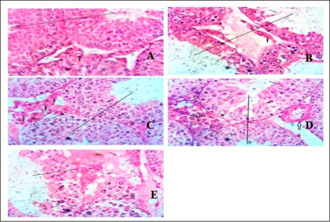 Showing the testes of mice. Group A shows the normal testes consisting of numerous seminiferous tubules (ST) which compose of spermatogenic cells (germ cells) at varying degree of maturation. Group B shows scanty interstitial cells. Seminiferous tubules are separated by wide interstitium showing a possibility of degeneration of the spermatids. Group C shows a mild proliferation of interstitial cells (up arrow). Also the seminiferous tubules (ST) show spermatids at varying level of maturation Group D shows the blood vessel (up arrow). There is no remarkable inflammatory cell within the interstitial cell. Group E shows congestion of interstitial cell (ICG) and proliferation of interstitial cell. (x400) H&E