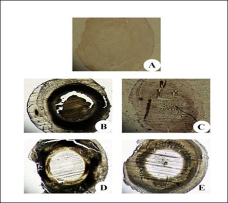 Immunohistochemistry of αA and αB crystallin in the eye lens from different experimental group animals. Lens sections were preincubated with anti- αA, αB crystallin polyclonal rabbit antibody (1: 500 dilution) and subsequently with goat anti-rabbit IgG-HRP (1: 3000 dilution). The immunoreactivity was developed with 0.01% DAB and H2O2. Note the brown colour formation that is indicative of peroxidase reaction in the nucleus. Inset (A): Physiological saline treated (group I); (B) Selenite treated (group II); (C) Selenium and resveratrol administered simultaneously (group III); (D) Resveratrol administered 24 h after treatment with selenite (group IV); (E) Resveratrol administered 24 h before treatment with selenite (group V).