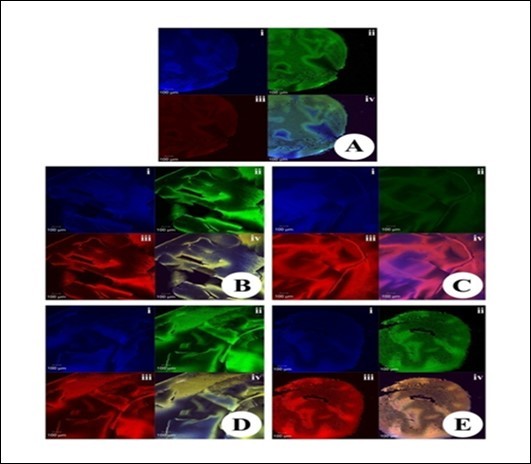 Immunofluorescence analysis for the expression of NF-kB in the eye lens from different experimental group animals. Lens section were pre-incubated with anti-p65/ NF-κB (at a dilution of 1: 500) and then with secondary antibody conjugated to FITC (at 1: 40 dilution) in the dark at room temperature for about 2 h. The sections were then counter-stained with either PI or DAPI. Please note the sub-insets i, ii, iii and iv in each of the insets indicate staining with DAPI (in blue), NF-kB (in green), PI (Red) and merged images respectively. The expression levels of NF-kB and PI were observed to be higher in group II in comparison to groups I, III and V. Inset (A): Physiological saline treated (group I); (B) Selenite treated (group II); (C) Selenium and resveratrol administered simultaneously (group III); (D) Resveratrol administered 24 h after treatment with selenite (group IV); (E) Resveratrol administered 24 h before treatment with selenite (group V).