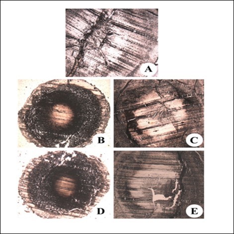 Immunohistochemical analysis of iNOS in the eye lens from different experimental group animals. Lens sections were preincubated with anti-iNOS polyclonal rabbit antibody (1: 500 dilution) and subsequently with goat anti-rabbit IgG-HRP (1: 3000 dilution). The immunoreactivity was developed with 0.01% DAB and H2O2. Note brown color formation indicative of peroxidase reaction in the nucleus. Inset (A): Physiological saline treated (group I); (B) Selenite treated (group II); (C) Selenium and resveratrol administered simultaneously (group III); (D) Resveratrol administered 24 h after treatment with selenite (group IV); (E) Resveratrol administered 24 h before treatment with selenite (group V).