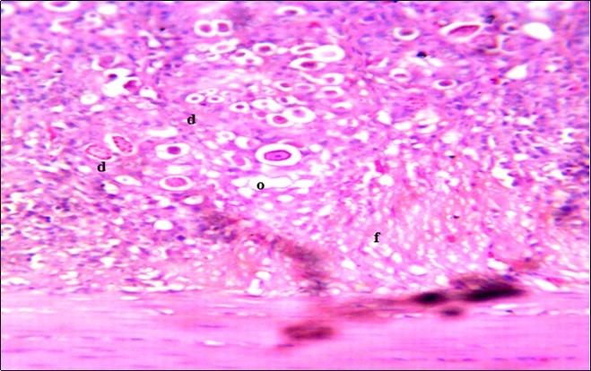 Photomicrograph of caecum of chick administered 20000 Oocysts of Eimeria tenella and treated with NeemAzal® Oil showing generalized degeneration of the caecal glands (d), moderate Ocysts presence (o) with fibrosis (f) X250 (H & E).