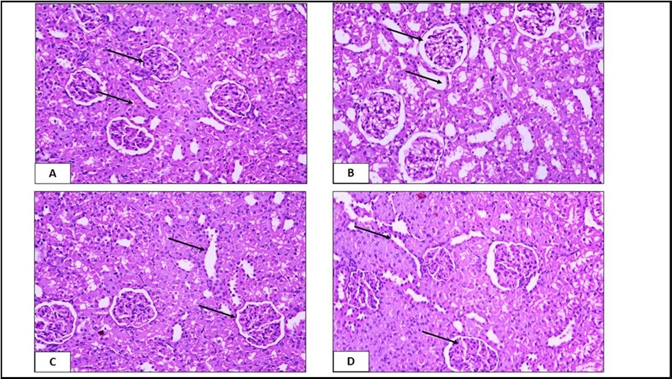 Photomicrographs of a section in the kidney tissue of the A) control group showing normal structure, B) EDTA treated group C) Trigonella foenum treated group D) EDTA + Trigonella foenum treated group (H&E, X. 400).