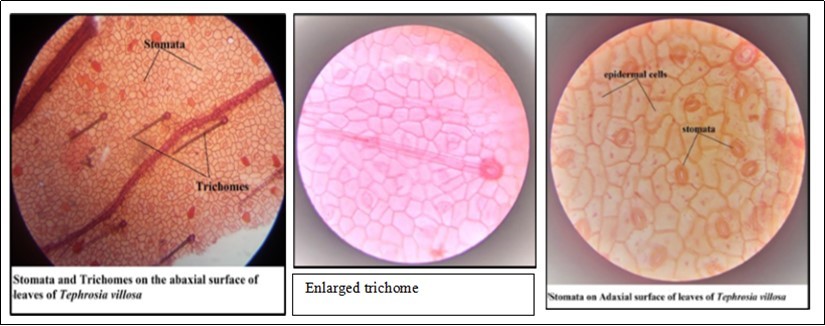 Micromorphology of leaves of Tephrosia villosa (abaxial surface and adaxial surface)