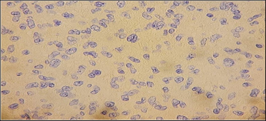 Immunohistochemistry Staining results. Desmin showed negative staining of cells.