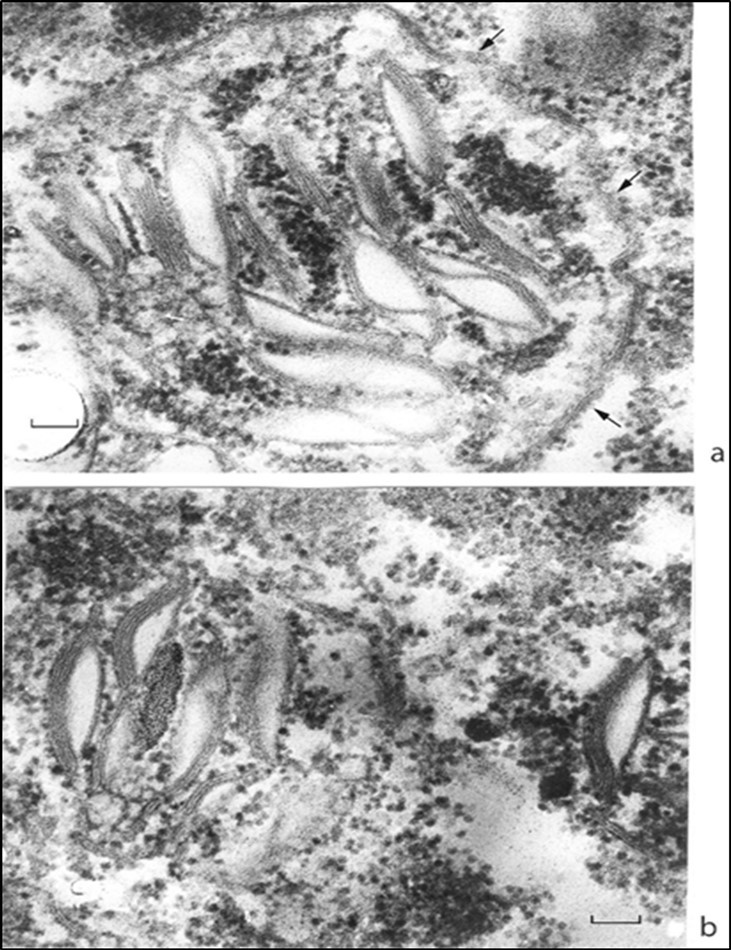 Juvenile chloroplasts at high magnification. (a) Stacks of granal thylakoids are enclosed with an incompletely formed envelope; (b) are envelope-free. Cytoplasmic ribosomes make a common field both inside and outside the body of a chloroplast. Envelope fragments are shown by arrows. Scale bar, 0.1 mm.