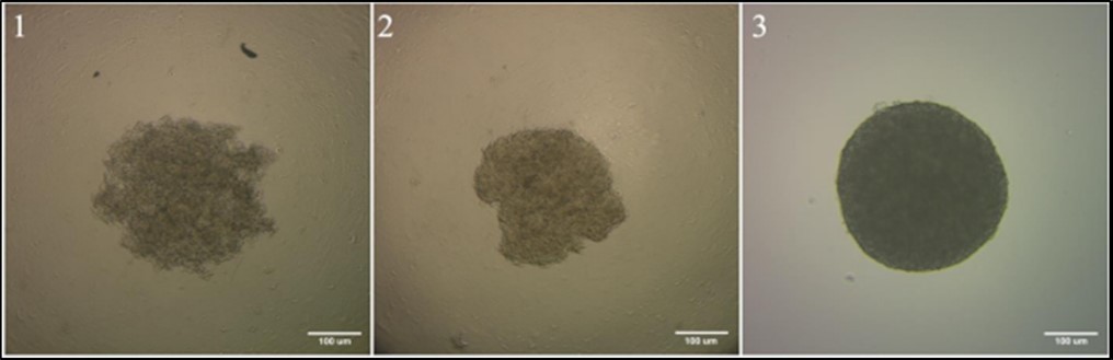 Stages of spheroid formation 1 - formation of tumor cells disc on the bottom of the well; 2 - aggregation of tumor cells; 3 - compaction and growth of tumor cells. melanoma cell culture #912, 33 passage. Zeiss Primo Vert phase contrast microscope (10x 0.25 Ph1). The scale bar is 100 µm.