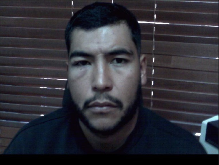 The clinical photograph of the patient shows moderate eyelid edema on the right side.