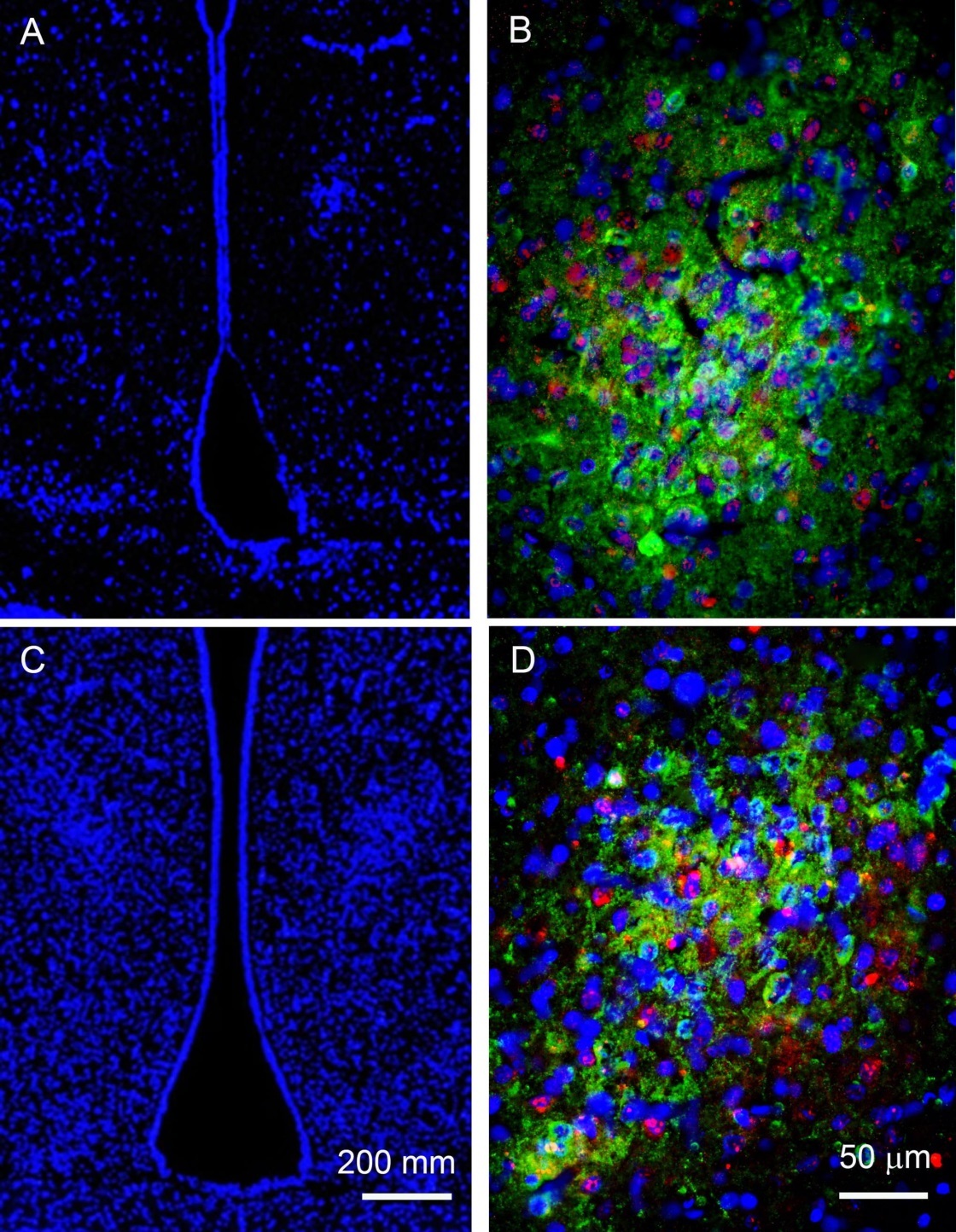 ERβ-immunoreactive (ir) cells in the sexually dimorphic nucleus of the preoptic area (SDN-POA). Images in the left column (A and C) show that the SDN-POA can be defined by its characteristic density (arrow-indicated) in association with the surrounding anatomical landmarks including the 3rd ventricle (3V) and the optic chiasm (OC). As shown in B and C, ERβ –ir localizes as spot-like deposits (red fluorescent label) mainly within the cellular nuclei, which are labeled with DAPI (blue fluorescent label). The CB28-ir cells are those that primarily display the intracellular green fluorescent signal. ERβ-ir cells in the SDN-POA can be either CB28-ir positive or CB28-ir negative. All images here were acquired from adult animals.