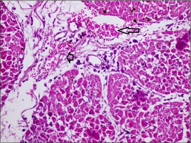 Heart (dead cattle less than 1 year old) showed area of extravasated blood with few inflammatory WBCs (arrows). (Hematoxylin and fuchsin X 40)