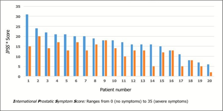 Urinary symptoms, evaluated according the IPSS* score, in patients with benign prostatic hyperplasia before(blue) and after (red) Lycoprozen®treatment