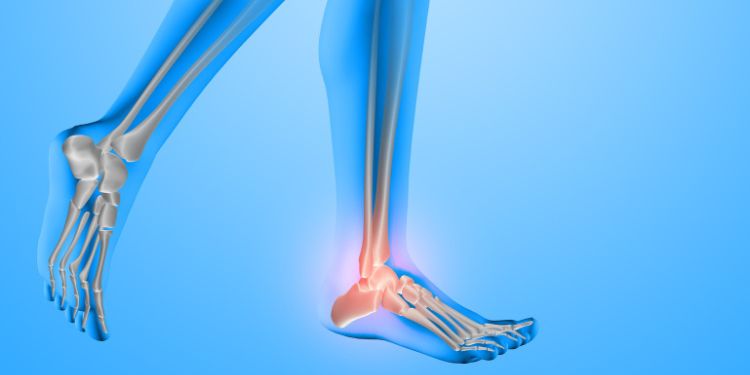 Article: Incidence and Management of Sural Neuritis Post-Peroneal Tendon Repair – Case Series