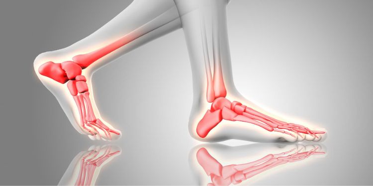 Article: From Pelvis to Foot, Part II: A Longitudinal Kinetic Chain Hypothesis for Eversion Ankle Sprains in Athletes